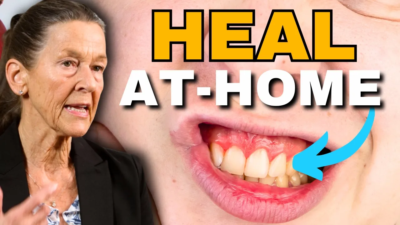 Outline Video Quickly Heal Gingivitis & Bleeding Gums Naturally at Home