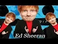 Lagu Castle On The Hill but Ed Sheeran won't stop breaking his leg