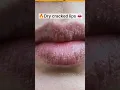 Download Lagu Dry lips home remedy 💯| Dry cracked lips treatment| #shorts #drylips #viral #ytshorts