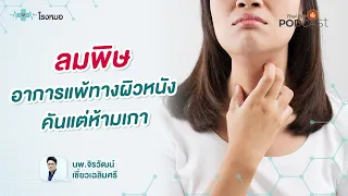 ผื่นลมพิษเกิดจากสาเหตุอะไรบ้าง