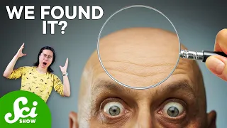 Can Baldness Be Reversed