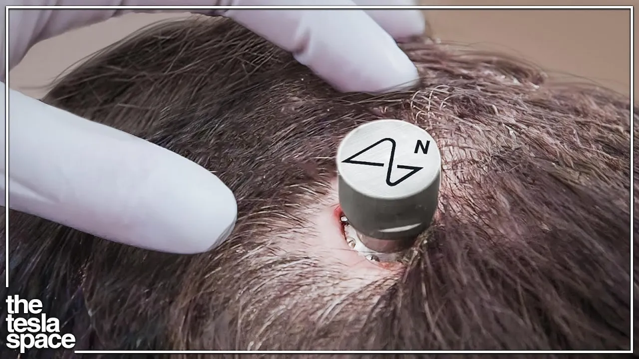 Cover image for Neuralink's FDA Approved Brain Implant: Revolutionizing Neurotechnology