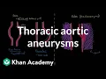 Thoracic aortic aneurysms Circulatory System and Disease NCLEX-RN Khan Academy