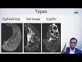CT imaging and diagnosis of Bronchiectasis