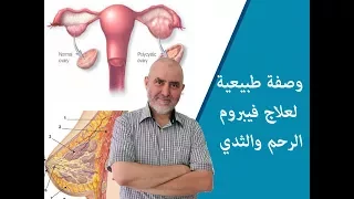 وصفة طبيعية لعلاج فيبروم الرحم والثدي الدكتور عبد الكريم العابد العلوي 