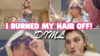 CHAOTIC VLOG! I burned my hair off