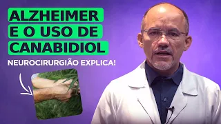 Como é o Tratamento com Canabidiol para Alzheimer? Neurocirurgião Explica!