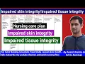 Nursing care plan on Impaired skin tissue integrity anandsnursingfiles