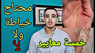 ازاي تعرف اذا كان الجرح محتاج خياطة و لا لأ  ٥  علامات   هتساعدك في الحكم دندنها