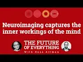The future of neuroimaging