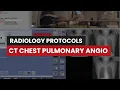 Download Lagu Pulmonary Angiography CT Protocol: A Guide for Rad Techs