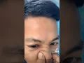 Download Lagu Nose oil check | Did it neatly | Blackheads Free