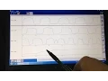 Ford Catalyst Efficiency Codes P0420 P0430 Explained