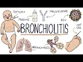 Understanding Bronchiolitis