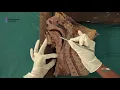 H N Part-1 Mid Sagittal section