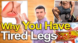 Download TIRED LEGS Are Warning You - Tired Legs and Leg Pain Causes, Natural Treatments, And How To Fix Them MP3