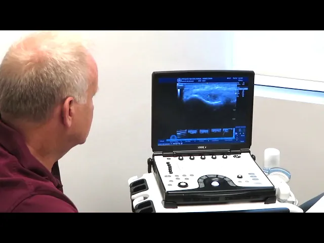 Tennis Elbow Treatment With PRP Injection | Fort Lauderdale, FL