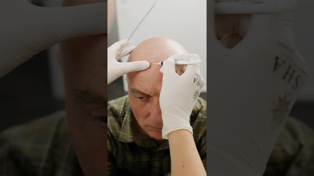 Video from Dasha Cosmetic & Medical Tattoo