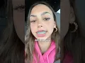 These braces colors make your teeth YELLOW