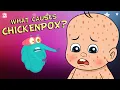 What Causes Chickenpox The Dr Binocs Show Best Learning s For Kids Peekaboo Kidz
