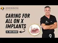 How to Care for Your All on X Implants