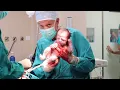 Download Lagu 🐣🐣 Live #caesarean birth of twins. Watch the father’s face 😅