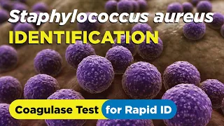 how to identify staphylococcus aureus using the coagulase test slide and tube method
