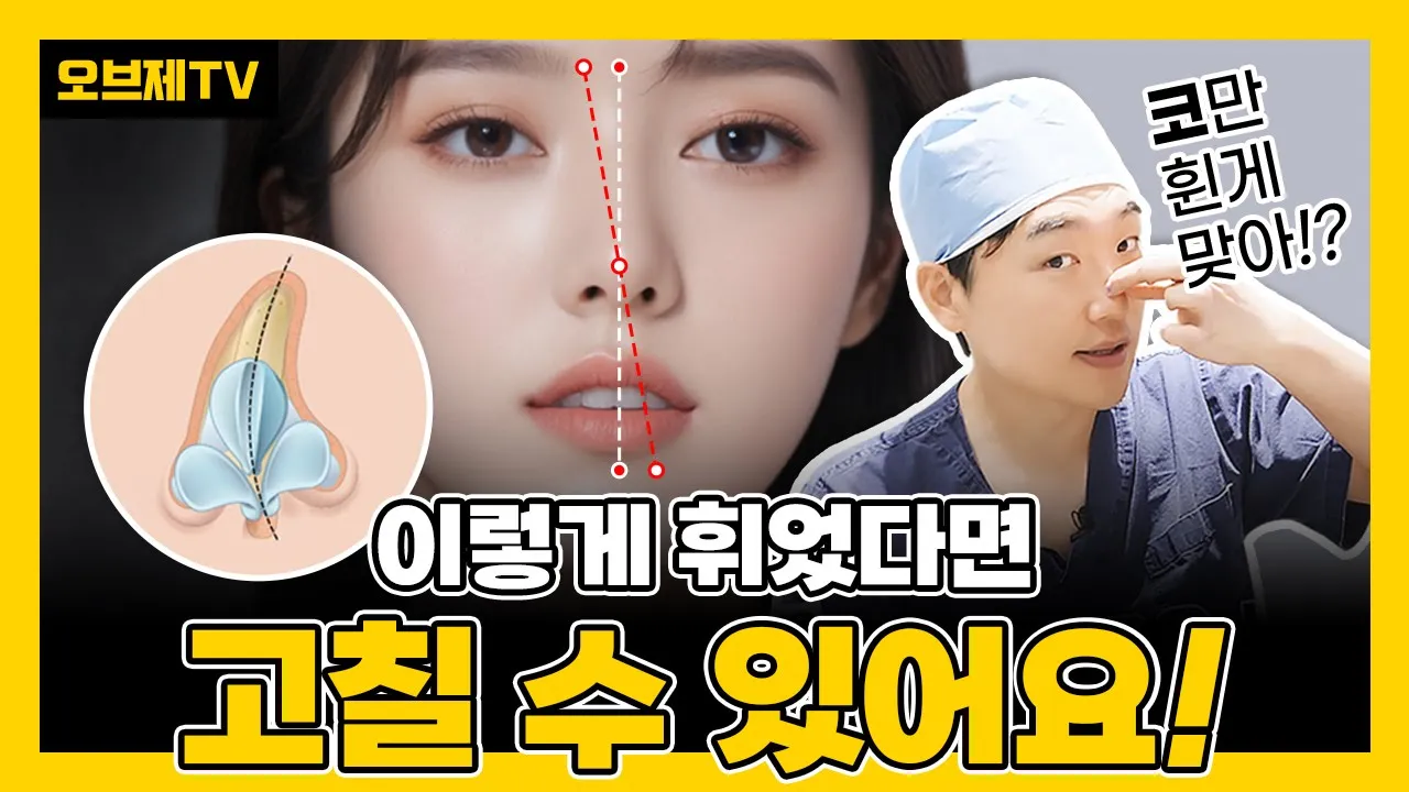 고칠 수 있는 휜코? 고칠 수 없는 휜코? | 오브제성형외과 이경묵 원장
