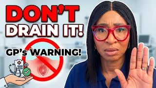bartholins cyst dont drain it until you watch this explained by uk gp