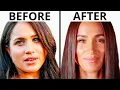 Meghan Markle s Royal Transformation Plastic Surgery Analysis