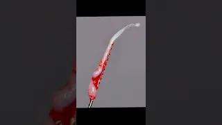 عصب السن الذي لو التهب لضاقت بك الأرض بما رحبت خلق الانسان ضعيفا Shorts 