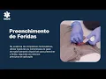 Download Lagu 15. Preenchimento de feridas (wound packing)