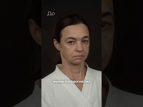 Омоложение в 2 этапа. Доктор КОЗЬМЕНКО И.Н.