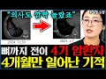 Download Lagu 뼈까지 전이된 4기 폐암 환자 '이것' 바꾸고 4개월만 기적 일어났다 l소장 류은경(1부)