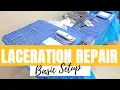 BASIC SET-UP LACERATION REPAIR OF RIGHT