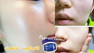 By God Then By God The Face Will Be Whitened And Wrinkles Will Disappear Forever For White Skin 