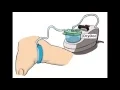 PureWick User Instructions