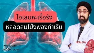  อาการของหลอดลมโป่งพองที่บ่งบอกถึงการกำเริบมีอะไรบ้าง 