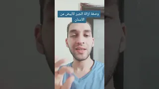 إزالة الجير الأبيض من الأسنان 