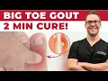 Gout Attack in the Big Toe Joint Foot Diet Treatment 2 MINUTES