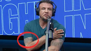 What Happened To Frank Mir s Right Arm