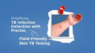 Why Precision Matters in TB Infection Detection | Simplifying with TB Skin Test