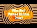 Download Lagu Ultra High Pitch Tinnitus Therapy - Relief for Ringing In The Ears and Sensorineural Hearing Loss