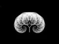 Fractal Tree Morph animation 4K