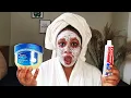 I APPLIED COLGATE TOOTHPASTE VASELINE ON MY FACE SEE WHAT HAPPENED AFTER