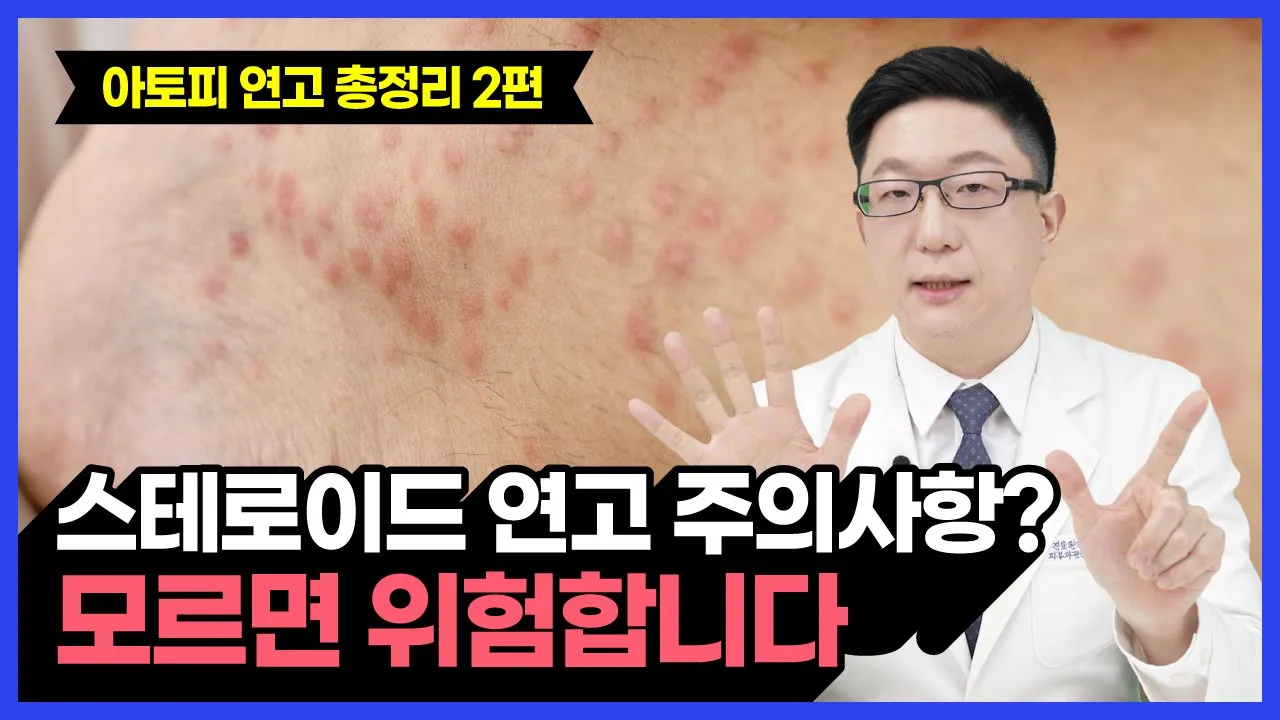 피부과전문의가 알려주는 스테로이드 연고 주의사항 (아토피 연고 2편)
