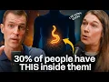Download Lagu Signs That You Have a PARASITE (How to Cleanse Naturally) | The Worm Queen