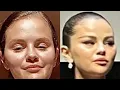 Celebs Who Are UNRECOGNIZABLE After Ruining Their Face In New Photos