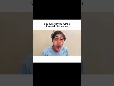 Aku malah di sengat tawon‼️