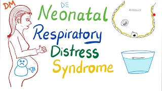 Neonatal Respiratory Distress Syndrome (NRDS) - Pediatrics - Pulmonology